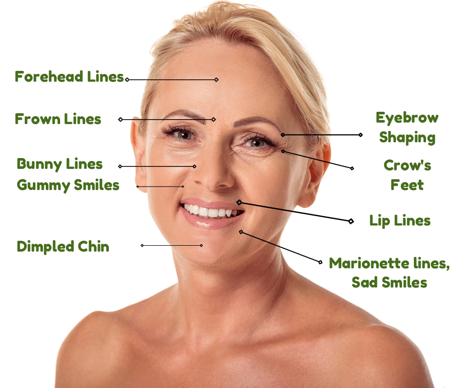 8 Types of Wrinkles Smoothed by Botox & Dermal Fillers | Advanced Skin