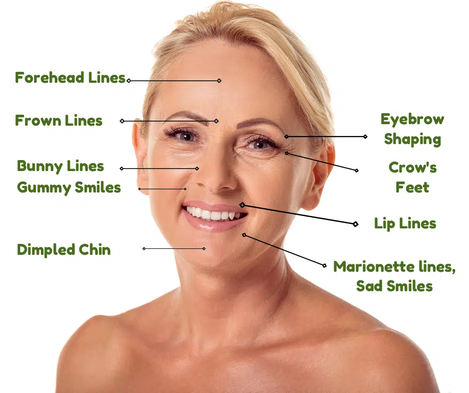 botox and dermal filler treatments