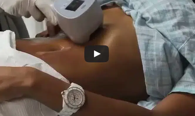 skin-tightening-video-advanced-skin-therapy-of-smokey-point