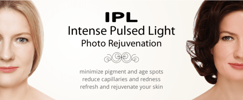 IPL Photofacials